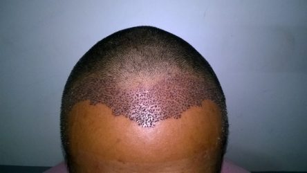 client9